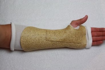 Volar splint