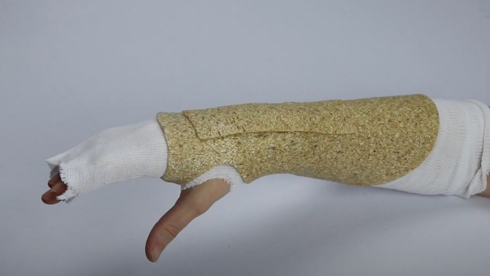 Dorsal splint