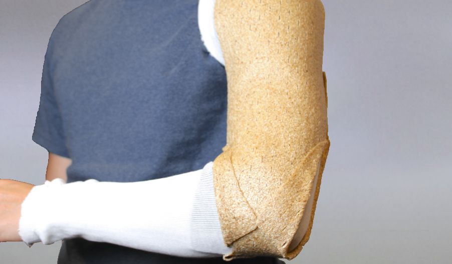 Humeral U-Splint