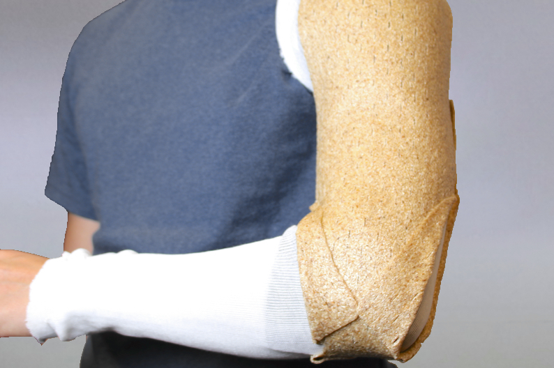 Humeral U-Splint