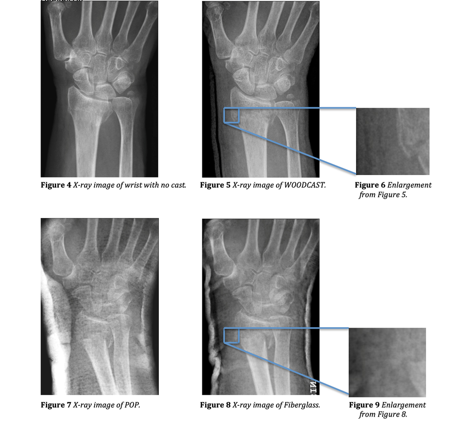 Radio-opacity of Woodcast